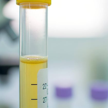 platelet rich plasma in a tube